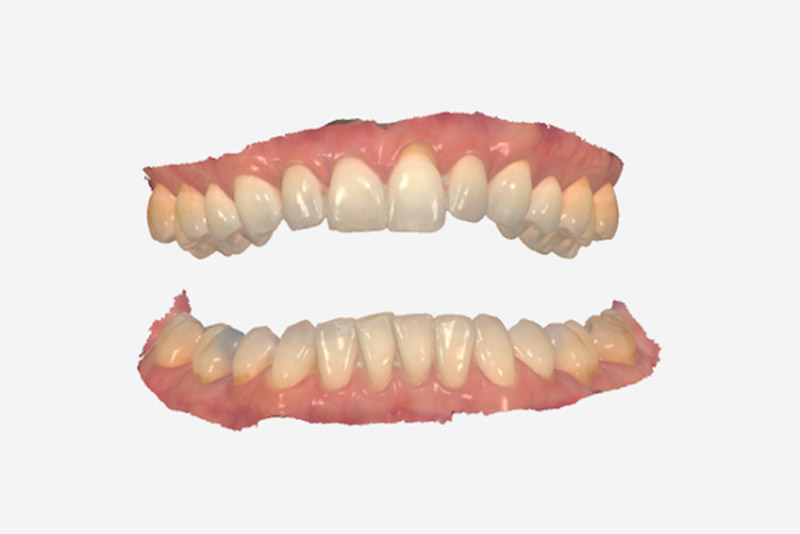 fgg